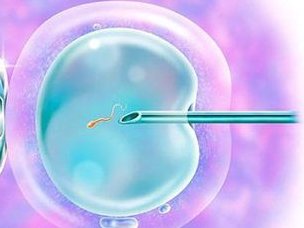 宁波生殖医院的试管成功率有多少？.的人多不多？