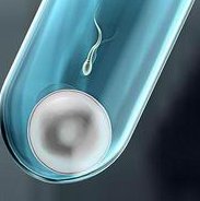 单角子宫患者必看：试管成功率低的原因与后续影响深度剖析