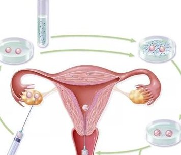 全国范围内三代试管私属机构一览，知名助孕公司大揭秘