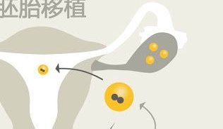 试管婴儿降调什么意思？哪些人做试管需要降调？